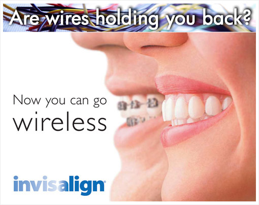 Invisalign You Can Trust - Coden