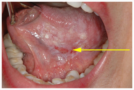 Treatment Of Mouth And Jaw Diseases Coden Specialists