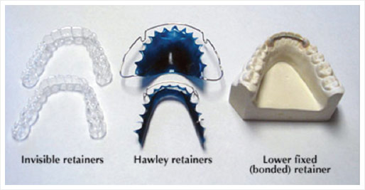 Retainer Sample